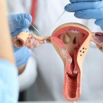 7 Langkah Penting untuk Merawat Kesehatan Sistem Reproduksi