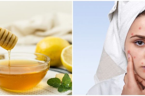 5 Cara Alami Memutihkan Kulit dengan Cepat dan Aman 5 Cara Alami Memutihkan Kulit dengan Cepat dan Aman