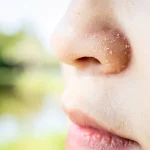 10 Tips Mengatasi Hidung Kering Secara Alami