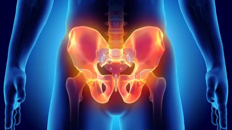 10 Tanda Masalah Kesehatan pada Area Panggul