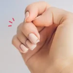 7 Cara Mengatasi Kuku Rapuh dan Mudah Patah