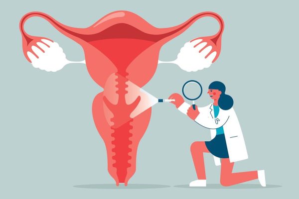 5 Cara Mendeteksi Kanker Serviks Sejak Dini