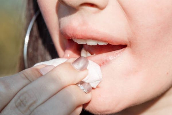 5 Cara Mencegah Bibir Kering Saat Puasa